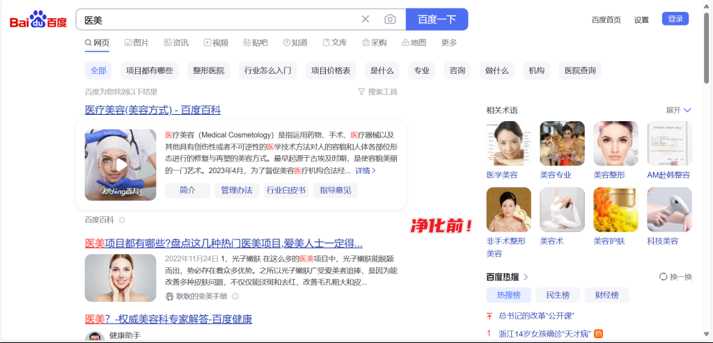 图片[4]-Washbaidu - 清洁百度搜索结果，提高百度搜索体验